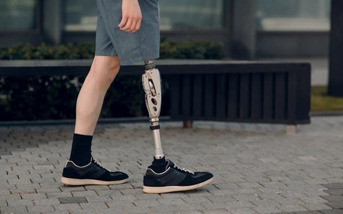 Як поводитись із людьми, що втратили кінцівки. Поради МОЗ