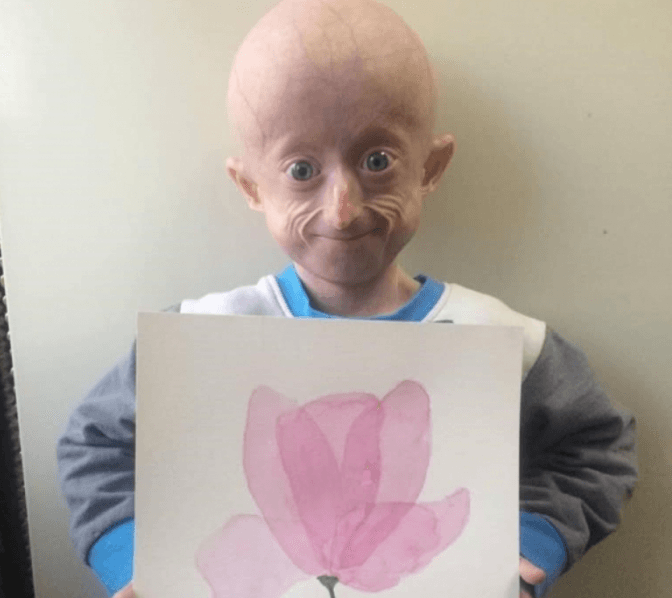 Львівське ательє шитиме хустини на підтримку дівчинки з рідкісною хворобою. Фото