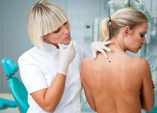 Стоп меланома. Мешканців Львівщини закликають безкоштовно обстежити родимки