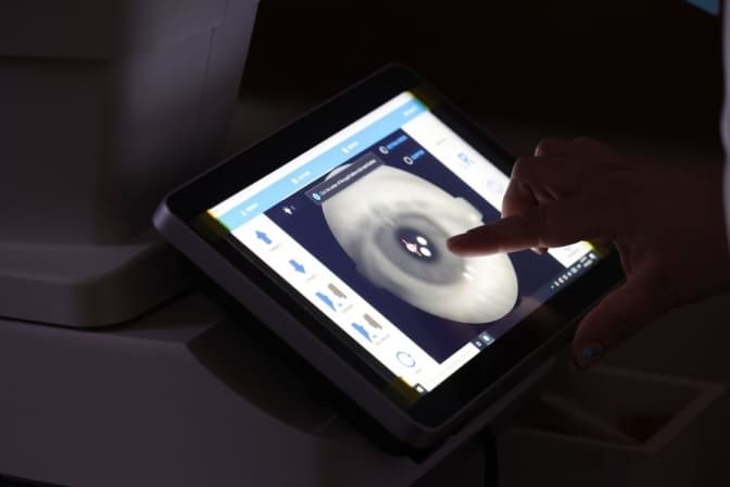 У львівській поліклініці штучний інтелект безкоштовно допомагає виявити ускладнення діабету