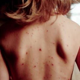 Неправильна постава спричиняє проблеми зі здоров'ям