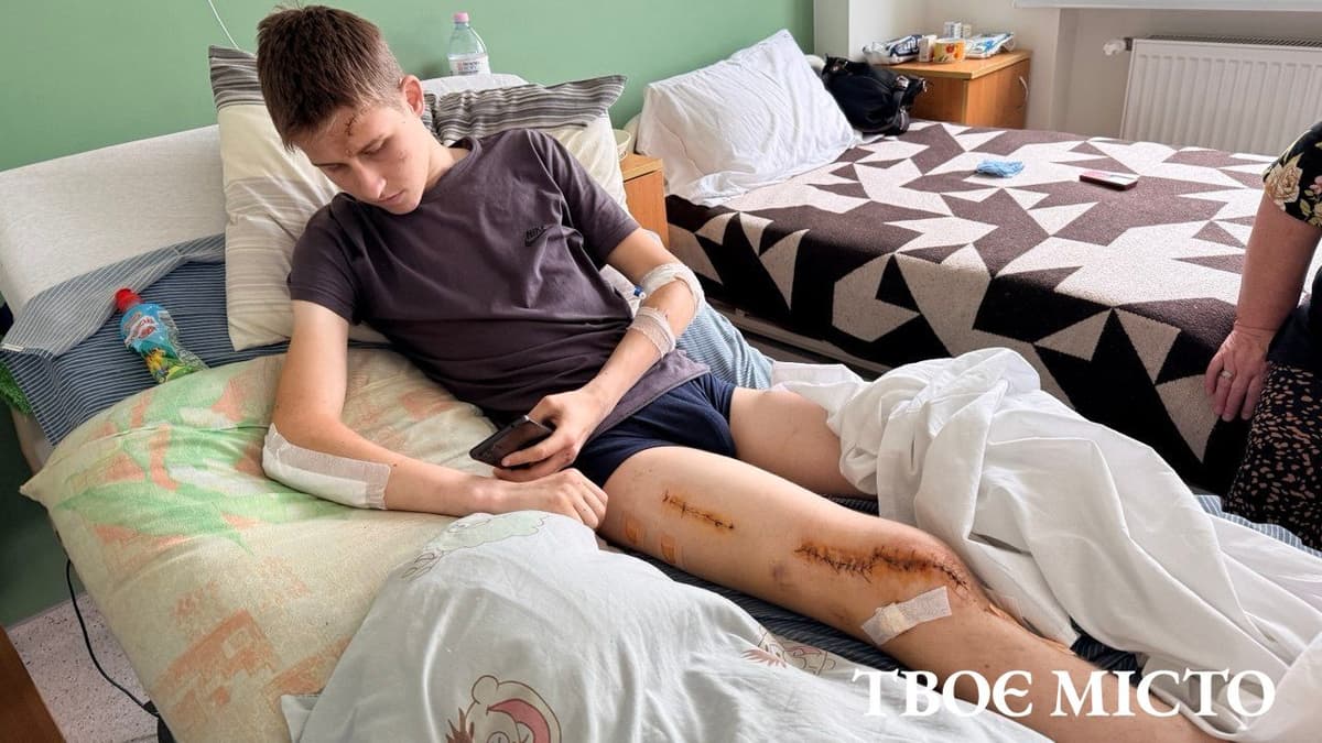Понад пів сотні дітей у лікарнях: у Львові зросла кількість травмованих водіїв електросамокатів