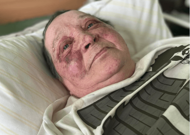 Львівські медики врятували волонтерку з Херсона, яку побили окупанти через український паспорт