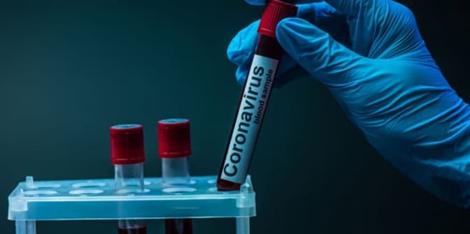 На Львівщині за добу – майже 700 нових хворих на Covid-19