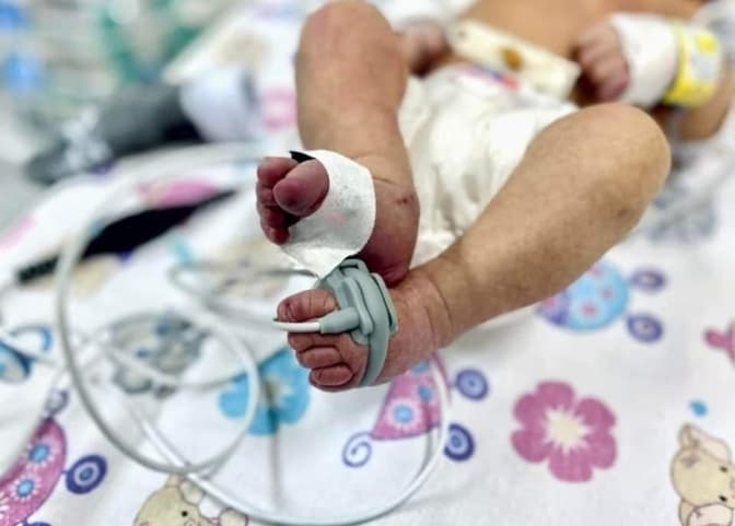 У Львові збиратимуть кошти на реанімобіль для передчасно народжених дітей