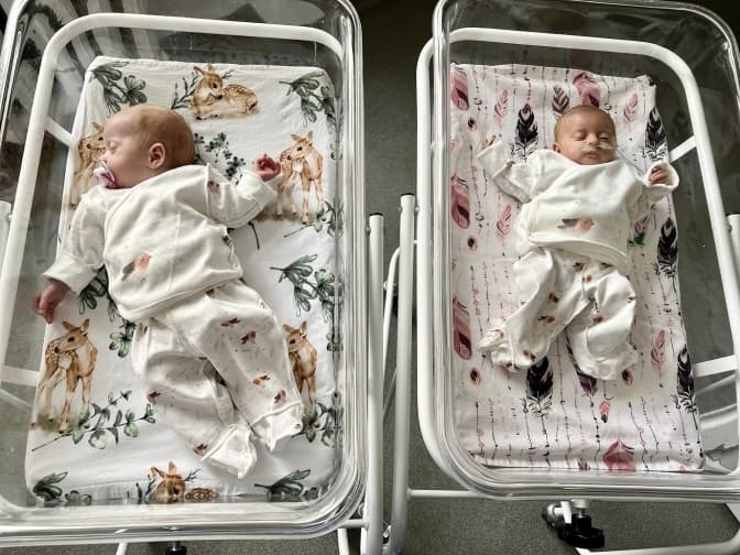 «На межі життя і смерті». Львівські лікарі врятували недоношених близнят