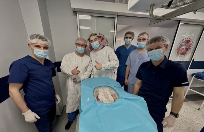 Львівські медики вперше задіяли апарат, що продовжив життя органа поза тілом