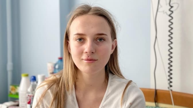 У Львові хірурги зі США прооперували 20-річну дівчину із вродженою вадою обличчя