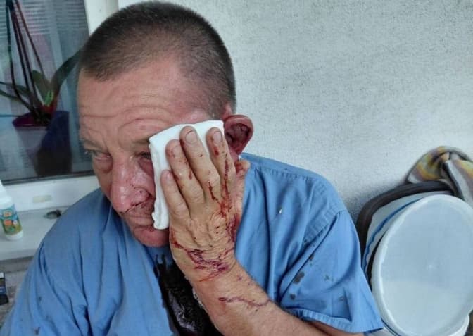 На Київщині підлітки побили батька загиблого нацгвардійця