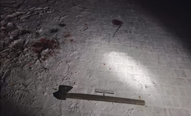 На Львівщині чоловік у парку вдарив жертву сокирою в голову