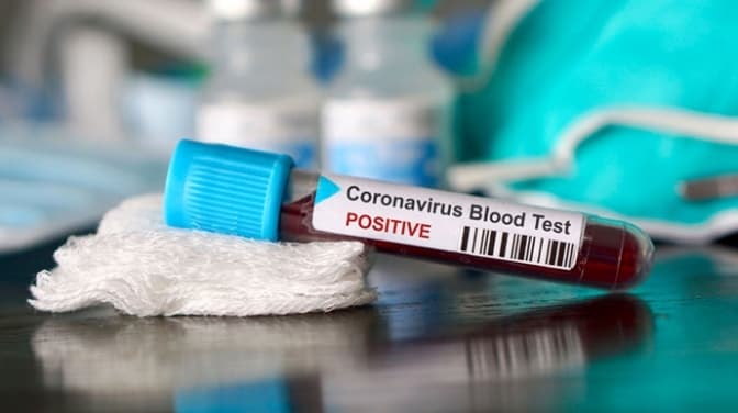 Львівщина – у трійці лідерів за добовою смертністю від Covid-19. Статистика