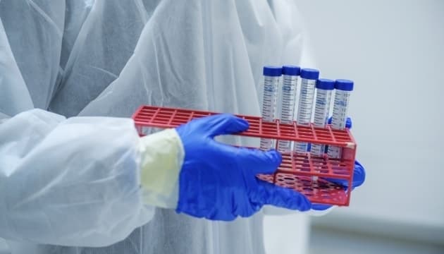 Від ускладнень коронавірусу на Львівщині померла людина