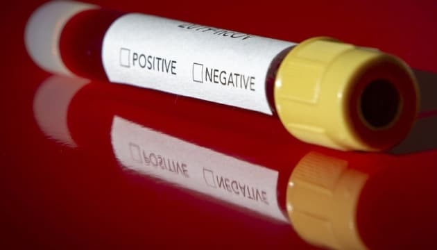На Львівщині від коронавірусу померли вже четверо людей