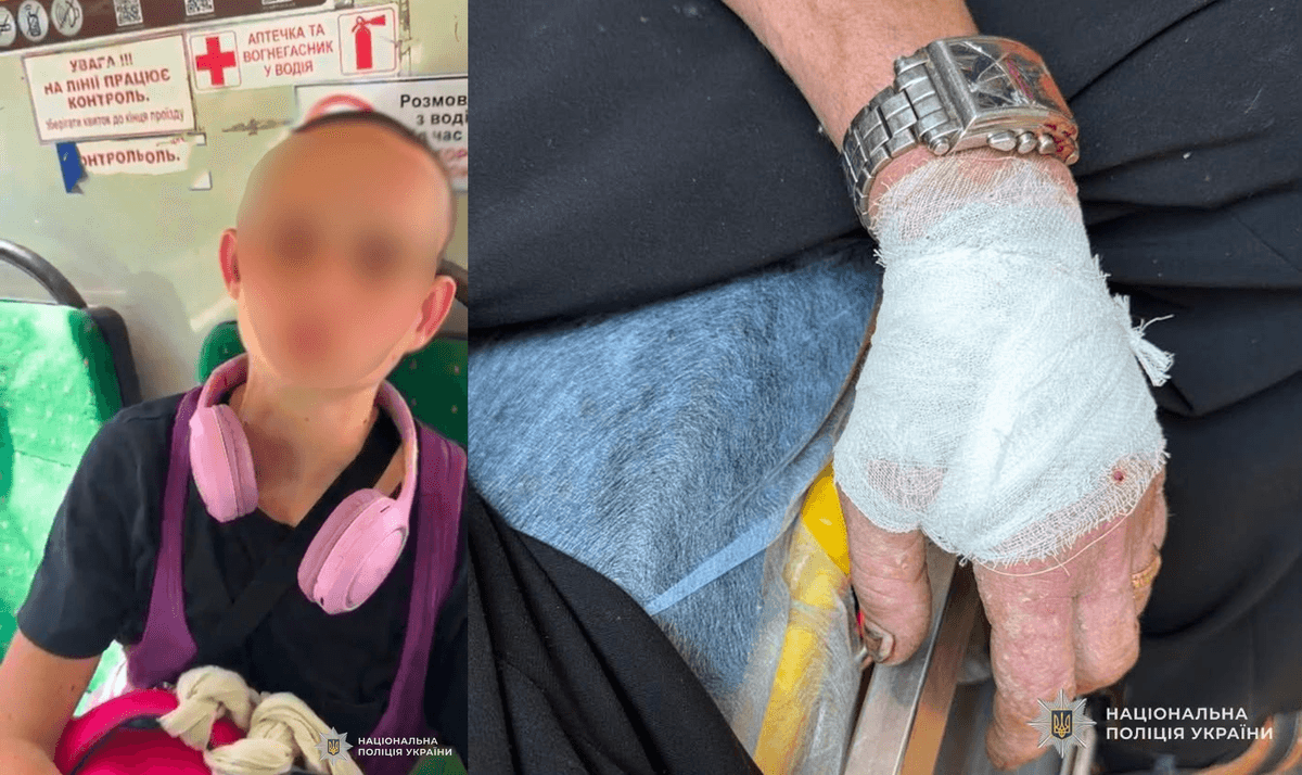 Жінці з Черкас, яка у Львові з ножем напала на пасажира маршрутки, загрожує до 7 років в'язниці