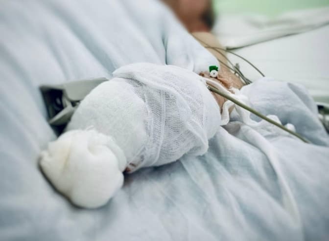 У Львові виявили перший випадок обмороження. Як діяти