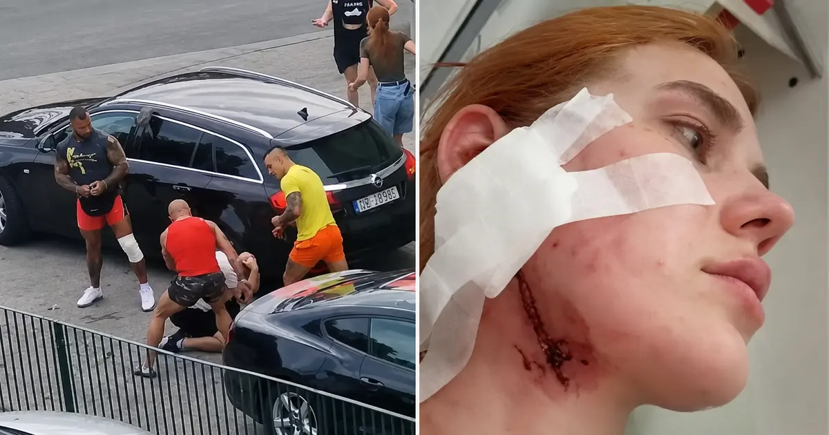 "Напали через українську мову": родина заявила про побиття двох українців у Польщі