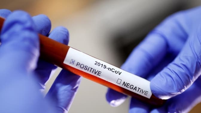 Кількість хворих на коронавірус на Львівщині зросла на 20%