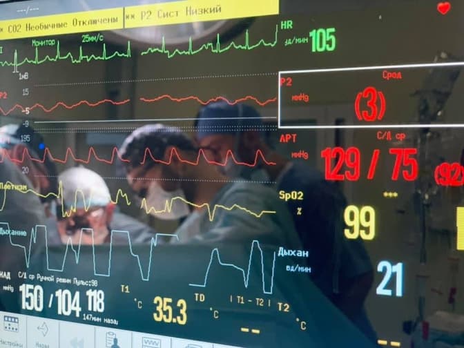 У львівській обласній лікарні вперше зробили пересадку серця