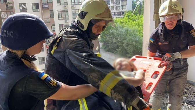 Травмована 7-річна дівчинка внаслідок попадання російської ракети у житловий будинок в Києві 26 червня / Фото: ДСНС