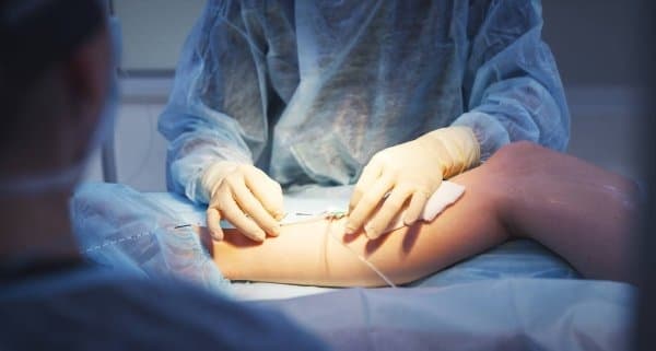 Львівські лікарі прооперували 17-річного хлопця після ДТП з величезною рваною раною