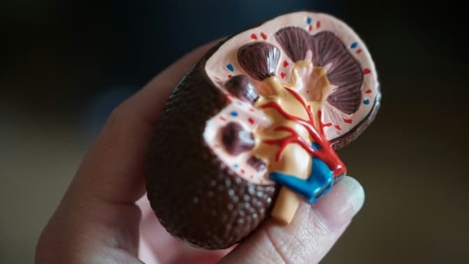 Сечокам'яна хвороба. Що робити після видалення каменів