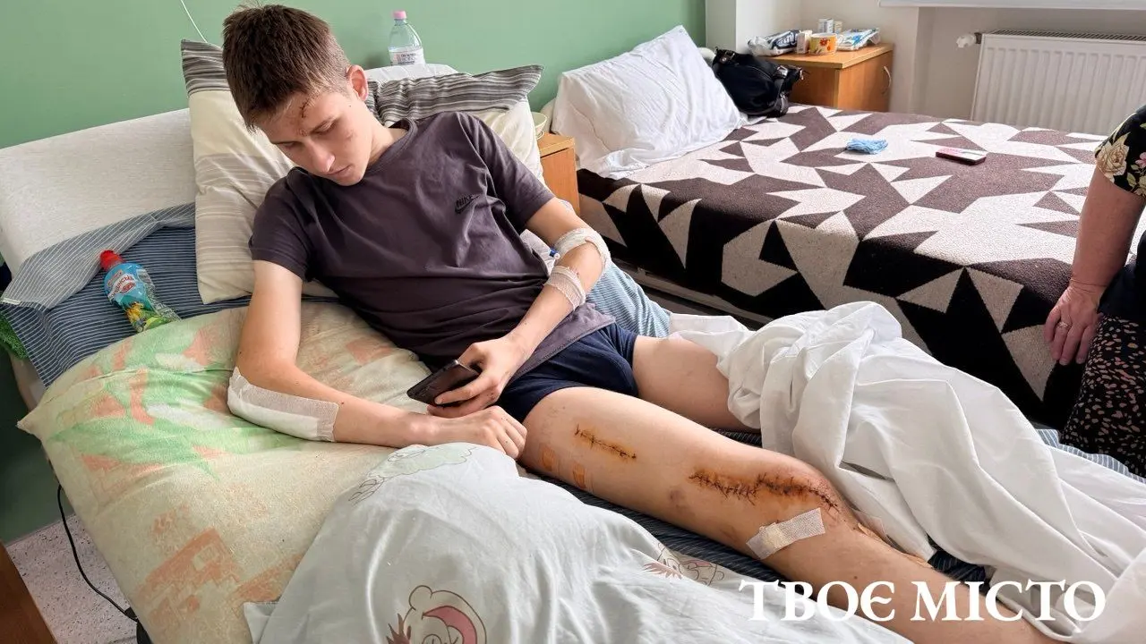 За дев’ять тижнів до лікарень Львова звернулися 126 травмованих водіїв електросамокатів