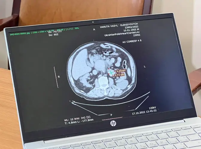Львівські хірурги під час майже 9-годинної операції врятували чоловіка з рідкісною патологією
