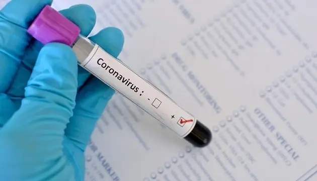 Чому в Україні різко зростає кількість нових хворих на Covid-19. Пояснення епідеміолога