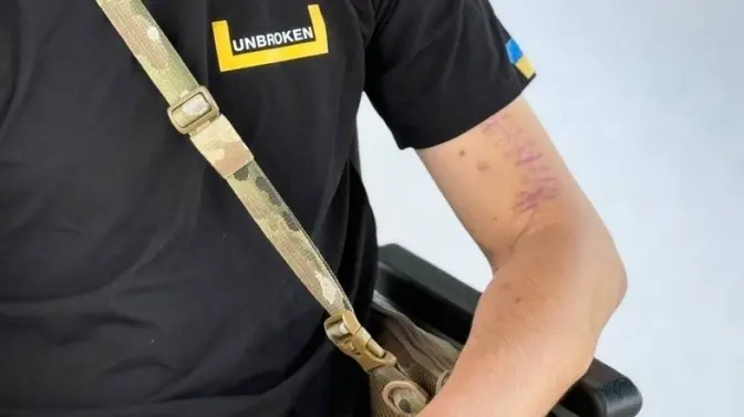 Фото: Unbroken University