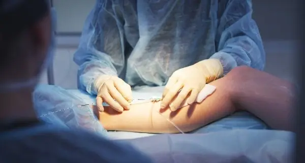 Львівські лікарі прооперували 17-річного хлопця після ДТП з величезною рваною раною