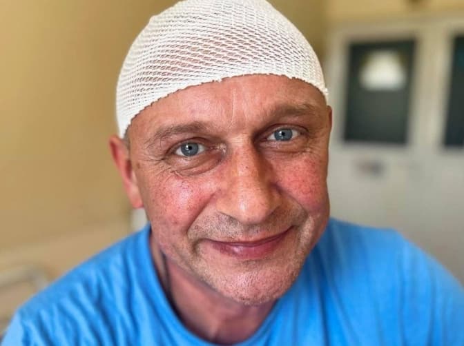 Львівські нейрохірурги видалили гігантську пухлину мозку чоловіку, який збирався їхати на фронт