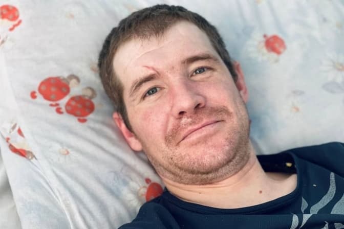 Львівські медики лікують донеччанина, який отримав важкі опіки, рятуючи безхатьків