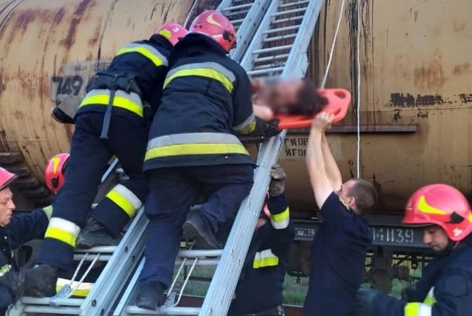 Дівчині Ірині, яка отримала 70% опіків тіла у Львові, потрібна допомога. Як долучитись