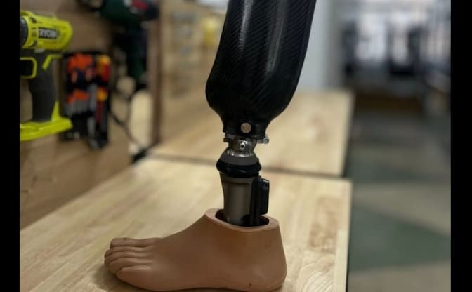 У Львові повноцінно запрацювала найбільша в Європі університетська протезна майстерня