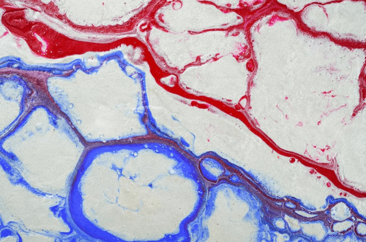 Коли потрібно зробити УЗД судин. Пояснення лікаря