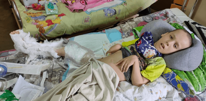 Терпить біль щодня. Львів’ян просять допомогти хлопцеві із ДЦП