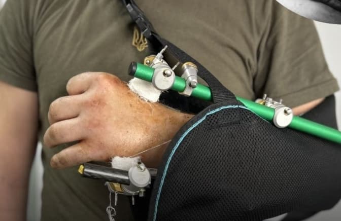 фото: перше тмо