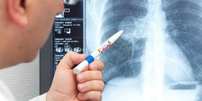 Львівські медики успішно вилікували 2-річну дитину з пневмонією