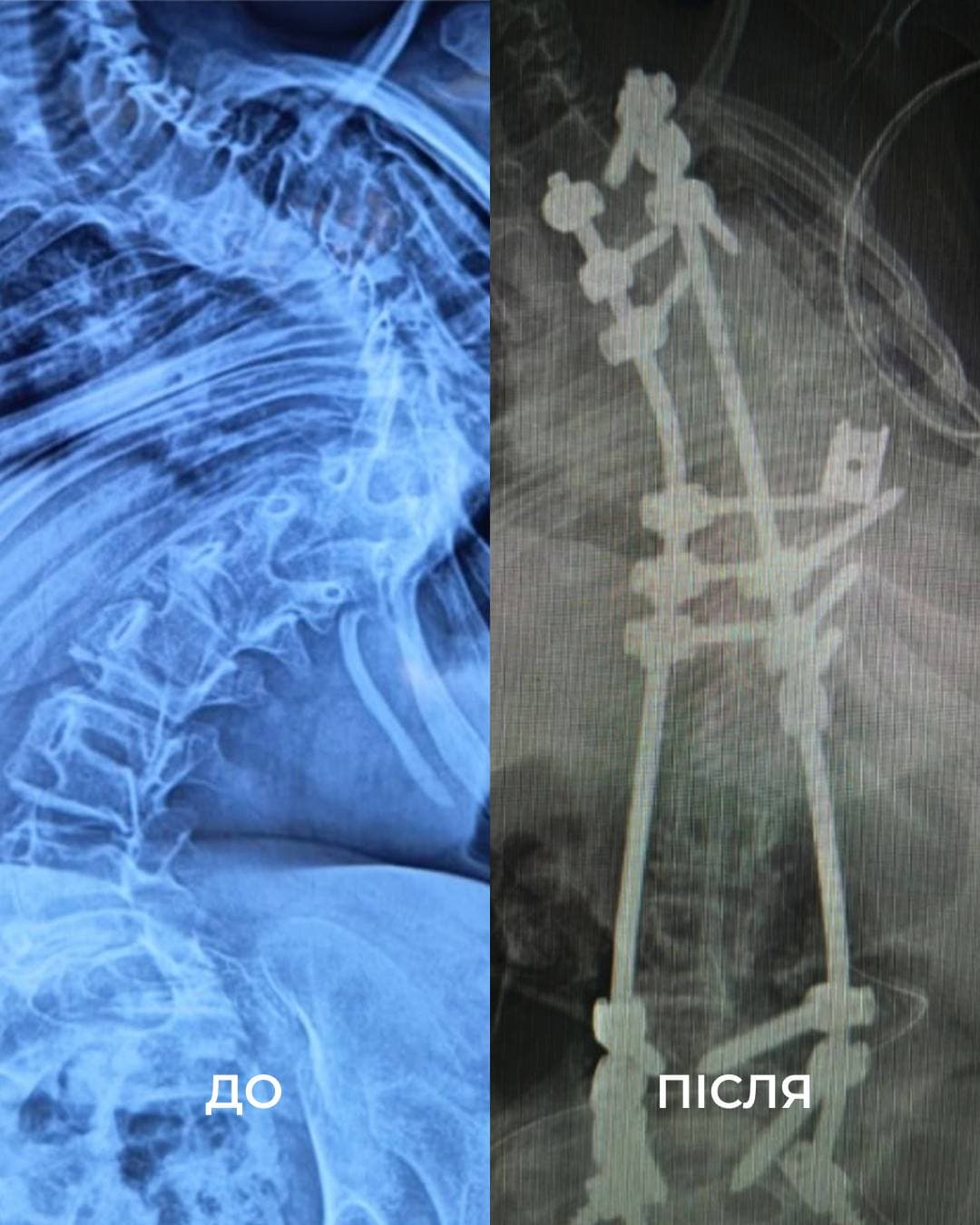 фото: перше тмо