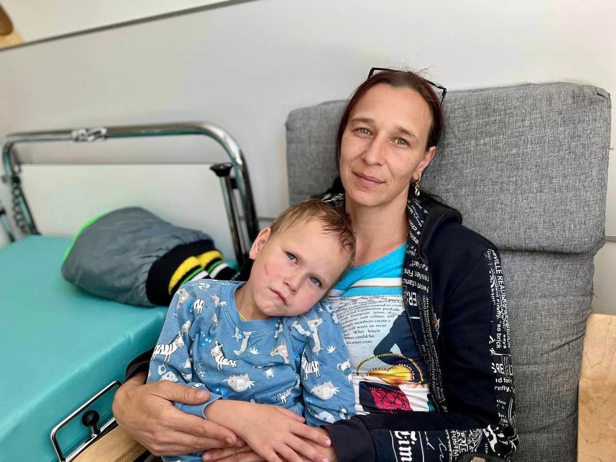 Складно було говорити та їсти. У Львові прооперували 5-річну дитину