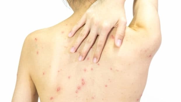 Фото: Depositphotos