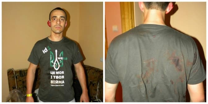 Міліція розшукує осіб, які у центрі Львова побили хлопця із тризубом на футболці