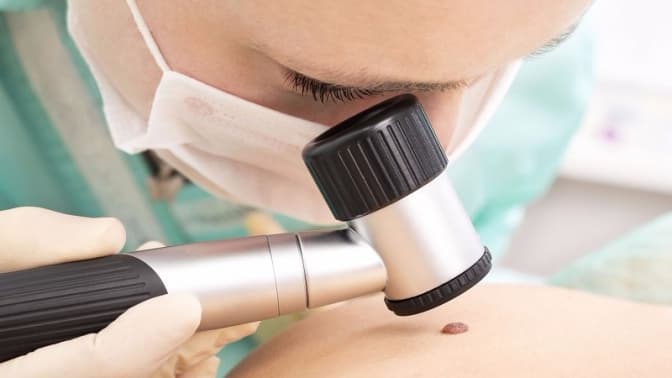 Як зменшити ризики захворіти на рак. Поради МОЗ