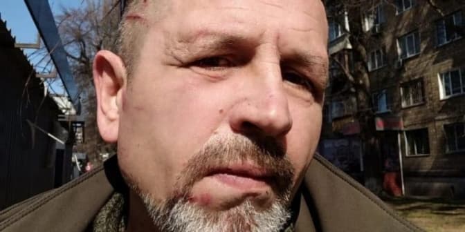 Про побиття у ТЦК в Києві заявив колишній бранець Кремля Володимир Балух. Там заперечують застосування сили