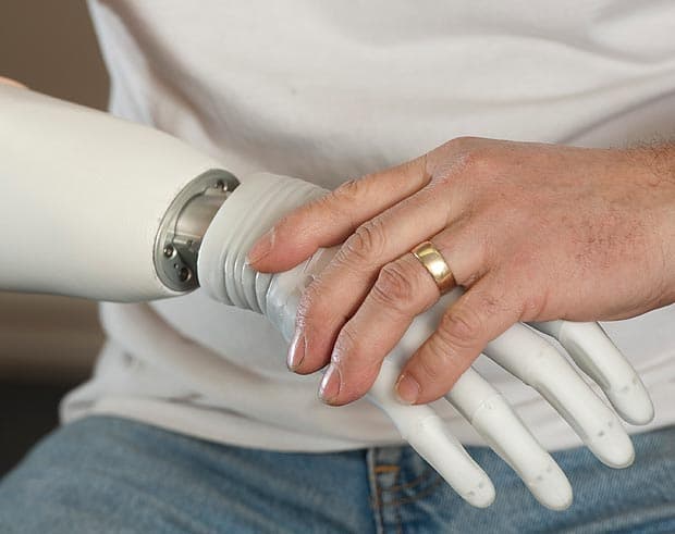 У Львові розробили електронний протез, що буде по кишені українцям